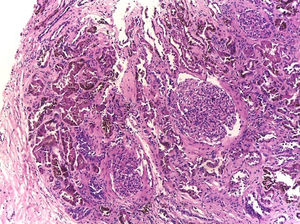 Hematoxylin–eosin stain – 10×.