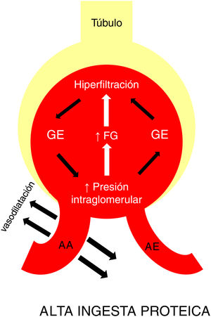 Una ingesta proteica elevada induce vasodilación en la arteriola aferente, generando aumento de la presión hidrostática intraglomerular y, en consecuencia, del filtrado. Este fenómeno aumenta el estrés oxidativo, estimula la síntesis de citokinas y los mediadores de inflamación, generando finalmente glomeruloesclerosis y fibrosis intersticial. Esta pérdida nefronal genera mayor sobrecarga sobre el resto de población funcionante y ya hiperfiltrante, amplificando y extendiendo el daño. AA: arteriola aferente; AE: arteriola eferente; FG: filtrado glomerular; GE: glomeruloesclerosis.