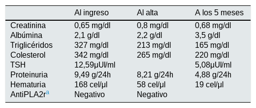Tablas
