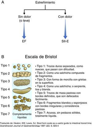 Tipos de estreñimiento. Fuente: Lewis y Heaton15.