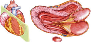 Esquema de plano paraesternal de eje largo.