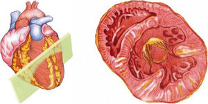 Esquema de plano paraesternal de eje corto