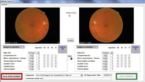 Pantalla del formulario de entrada en la base de datos para registrar las lesiones observadas a través de las imágenes retinográficas de cada paciente.
