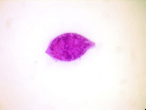 Hematoxilina eosina 40×. Huevo de Schistosoma haematobium eliminado por orina.