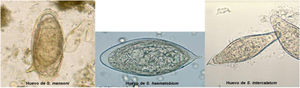 Imágenes de huevos de Schistosoma. Disponibles en: https://www.cdc.gov/dpdx/schistosomiasis/index.html [consultado 9 Mayo 2022].