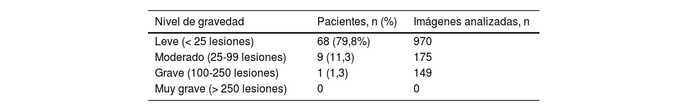 Tablas