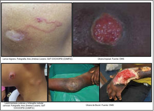 Principales lesiones dermatológicas