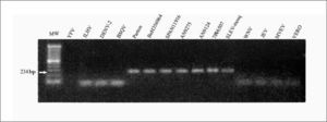 Agarose gel electrophoresis of SLEV-specific amplicons (234 bp) derived from RT-nested PCR. Amplifications were carried out with RNAs extracted from 7 strains of SLEV: Parton, BeH356964, SPAN11916, AN9275, AN9124, 78V6507, SLEV from a naturally infected mosquito pool (SLEV-mosq), YFV, ILHV, DENV-2, BSQV, WNV, JEV, MVEV and uninfected cells (VERO). MW, molecular weight marker (DNA ladder = 100 bp).