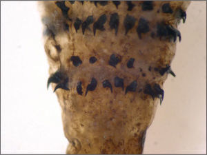 Detalle de las coronas de ganchos presentes en una larva en estadio II.