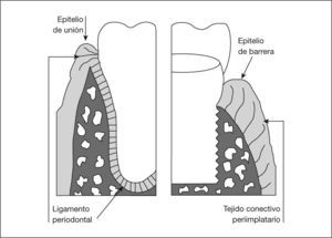 Esquema comparativo entre el tejido periodontal y el periimplantario.