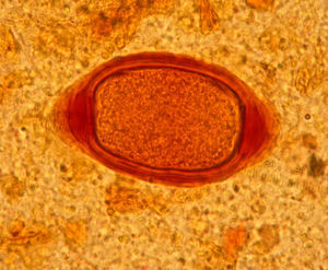Morfología del huevo hallado en las muestras (×1.000).