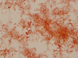 Tinción de Gram, donde se aprecia la morfología pleomórfica del bacilo gramnegativo Streptobacillus moniliformis.