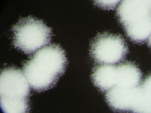 Micelios aéreos de Nocardia asteroides (×6).