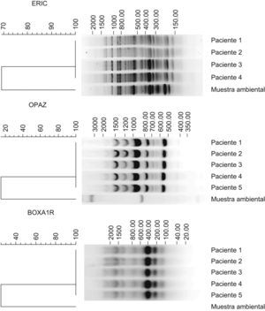 Tipificación de las cepas de Mycobacterium abscessus aislados de pacientes y el aislado del ambiente. El ADN de las cepas fue sometido a ERIC-PCR, BOXA1R y RAPD. Los dendogramas se realizaron con el programa de Bionumerics V4.5. Las cepas aisladas de los pacientes presentaron igual patrón genético (el 100% de similaridad) y la cepa aislada del centro mostró un patrón genético diferente al resto de los aislados (<80% de similaridad).