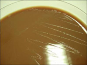 Placa de agar chocolate con colonias pequeñas con un tenue halo verdoso.