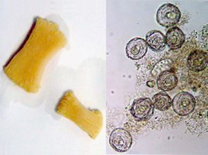 Segmentos de Bertiella studeri con proglótides grávidas agrupadas en cadenas y huevos liberados de estas.