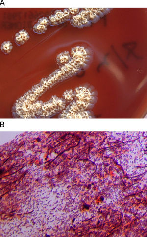 A) Irregular, rough, yellowish D. congolensis colonies in blood agar. B) Gram staining of the colonies showing gram-positive coccoid forms, some of them associated in parallel rows of chains, and long, irregular filaments.