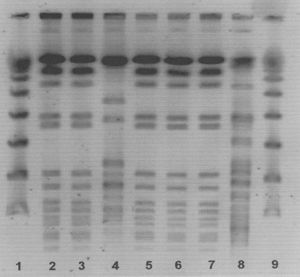 Perfiles de los fragmentos de ADN por PFGE de 5 cepas de Enterobacter sakazakii aisladas en el neonato infectado y en el preparado en polvo para neonatos. Líneas 1 y 9, marcador molecular de PFGE. Líneas 2 y 3, cepas de E. sakazakii aisladas en sangre y heces del neonato. Línea 4, cepa control de E. sakazakii. Línea 5, cepa de E. sakazakii aislada en la muestra abierta del preparado infantil del lote implicado. Líneas 6 y 7, cepas de E. sakazakii aisladas en las 2 muestras cerradas de preparado infantil del lote implicado. Línea 8, control negativo Acinetobacter baumannii.