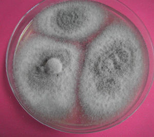 Aspecto macroscópico del hongo aislado (15 días de incubación).