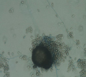 Morfología microscópica que muestra la presencia de cleistotecias (tinción con azul de lactofenol, 400×).