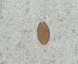 Huevo de Trichuris trichiura. Servicio de microbiología. (Imagen en fresco x40.)