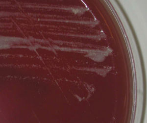 Morfología de la colonia de M. mucogenicum a los dos días de crecimiento en agar sangre.