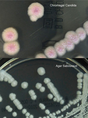 Morfología macroscópica de colonias tras 48h de incubación en agar Sabouraud y Chromagar Candida®.