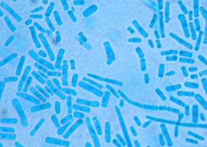 Tinción de azul de lactofenol (1.000X). Artroconidias y blastoconidias.
