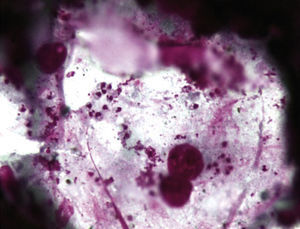 Parásitos de Leishmania intra y extracelulares.