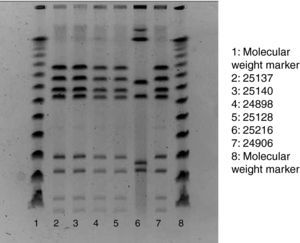 Pulsed-field gel electrophoresis of restriction fragments of the chromosomal DNA, obtained following the SmaI (Roche) restriction enzyme and protocol.