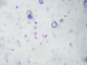 Imagen característica de la capa leucocitaria del microhematocrito teñida con Giemsa; se observan componentes sanguíneos y el agente causante de la infección.