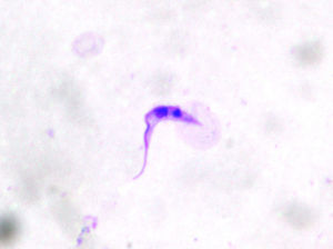 Imagen ampliada del parásito, en la que se puede observar su morfología característica.