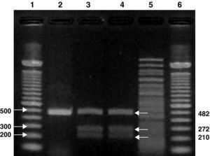 RFLP del gen aac(6′)-Ib-cr con la enzima BseGI en cepas de E.coli. 1: ADN ladder 100pb; 2: EC-322 (solo aac(6′)-Ib-cr )/BseGI; 3: EC-259 (aac(6′)-Ib-cr + aac(6′)-Ib)/BseGI; 4: EC-260 (aac(6′)-Ib-cr + aac(6′)-Ib)/BseGI; 5: ADN fago λ/BseGI; 6: ADN ladder 100pb. Tamaño en pb.