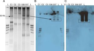 Extracción de plásmidos y resultado de las hibridaciones llevadas a cabo con sondas específicas para los genes de interés. A) Perfil de plásmidos obtenidos de los aislamientos clínicos de Enterobacter cloacae. B) Resultado de la hibridación con repL/M. C) Resultado de la hibridación con blaoxa-48. L: marcador de hibridación, DNA molecular-weight marker II dig labeled 0.12-23.1Kb (Roche, Mannheim, Alemania); C1: E.coli V517; C2: E.coli J53 pLac (183Kb); C3: E.coli J53 pR27 (153Kb).