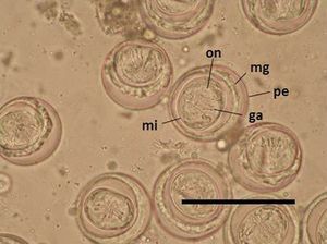 Huevos de Hymenolepis diminuta encontrados en las heces del infante. Se observa la pared externa (pe), la matriz gelatinosa (mg), la membrana interna (mi) y los ganchos (ga) de la oncosfera (on) (escala: 100μm).