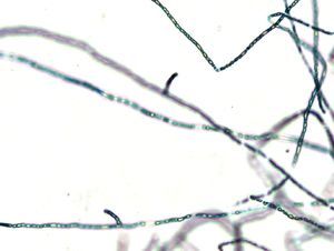 Pythium insidiosum. Tinción con azul de lactofenol.
