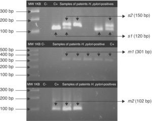 Fragments of s and m alleles from H. pylori vacA generated by nested PCR. MWM 1-kilobase DNA ladder; C− negative control (contain all the necessary components except template DNA); C+ positive control Helicobacter pylori J99, (HPJ99) genotype s1m1. Genomic DNA extracted from saliva or gastric biopsies.
