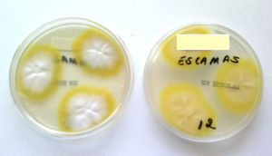 Cultivo en agar Sabouraud cloranfenicol actidiona, 30 días a 28°C.