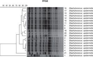 Dendrograma de las cepas de Staphylococcus epidermidis analizadas por electroforesis en campo pulsado (según el coeficiente de Dice).
