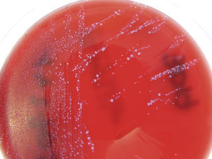 Primera tanda de hemocultivos, en los que se informó de la existencia de 2morfotipos de Enterococcus faecalis. Primer plano de la placa de cultivo.