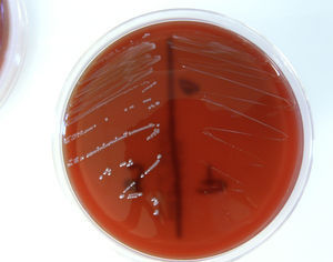 Aislamiento de los 2tipos de colonias de Enterococcus faecalis en placa de agar sangre (24h, 35°C): morfotipo «normal» y variantes de colonia pequeña o SCV.