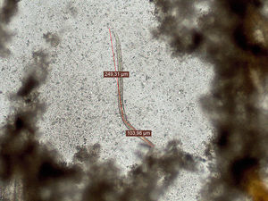 Microscopic observation of a larva in a stool sample concentrated in SAF fixative (100×). The total length of the larva is shown. Note the absence of genital primordium.