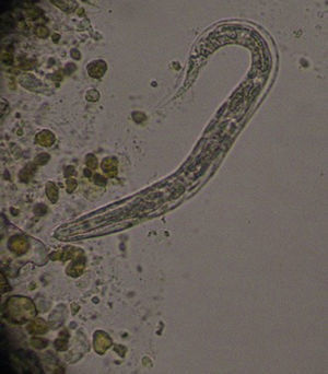 Larva rhabditoide 40× en examen microscópico de heces.