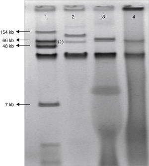 Gel electrophoresis of plasmid extraction by Kieser technique from Escherichia coli 50192 (lane 1), Klebsiella pneumoniae 11978 (lane 2), Enterobacter aerogenes clinical isolate (lane 3) and E. coli J53 harboring conjugant plasmid pOXA-48 (lane 4).