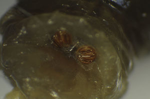 Espiráculos posteriores de la larva.
