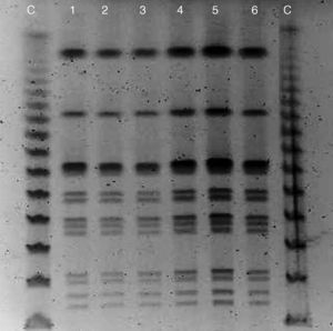 Pulsed field gel electrophoresis (PFGE) of restriction fragments from 6 cases of the outbreak (except the nurse). The pulsotype profiles are almost identical and they can be attributed to the same strain of Salmonella enterica serotype Newport.