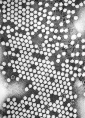 Tinción negativa del virus de la polio (Centers for Disease Control and Prevention).