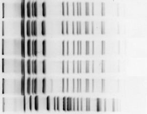 Dendograma generado a partir de los resultados de tipificación de los aislados de Burkholderia cepacia recibidos en el laboratorio del HUVM.