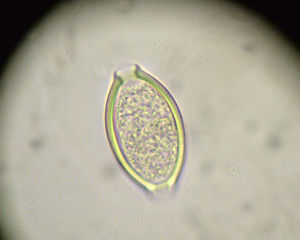 Huevos de Trichuris trichiura en muestra de heces.
