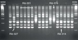 Gel de electroforesis de una PCR-ribotipado. Se muestran los perfiles de bandas obtenidos para algunos de los ribotipos más frecuentes en España (001, 014 y 078) junto con el ribotipo de referencia 027.